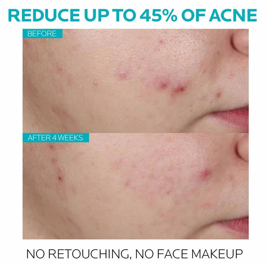 La Roche-Posay Effaclar Salicylic Acid Acne Serum